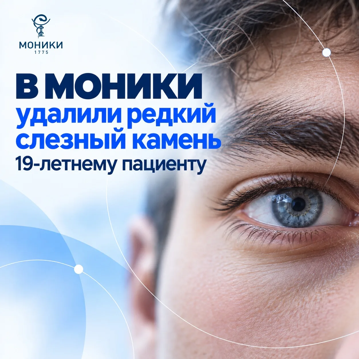 Врачи МОНИКИ удалили слезный камень: из-за редкого образования юноша полгода не мог изб...