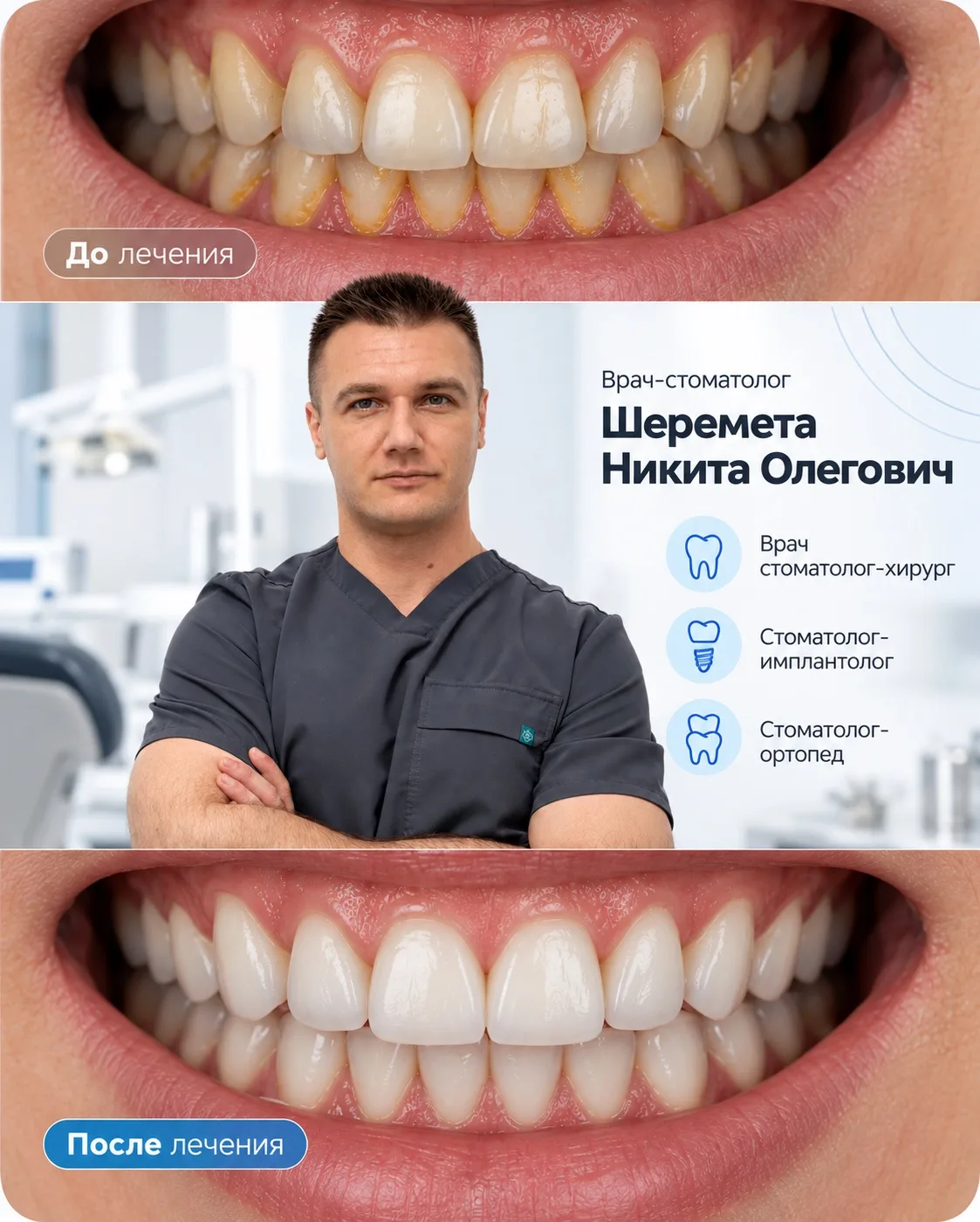 🦷 КРАСИВАЯ УЛЫБКА — РЕЗУЛЬТАТ ПРОФЕССИОНАЛИЗМА И ВНИМАНИЯ К ДЕТАЛЯМ!