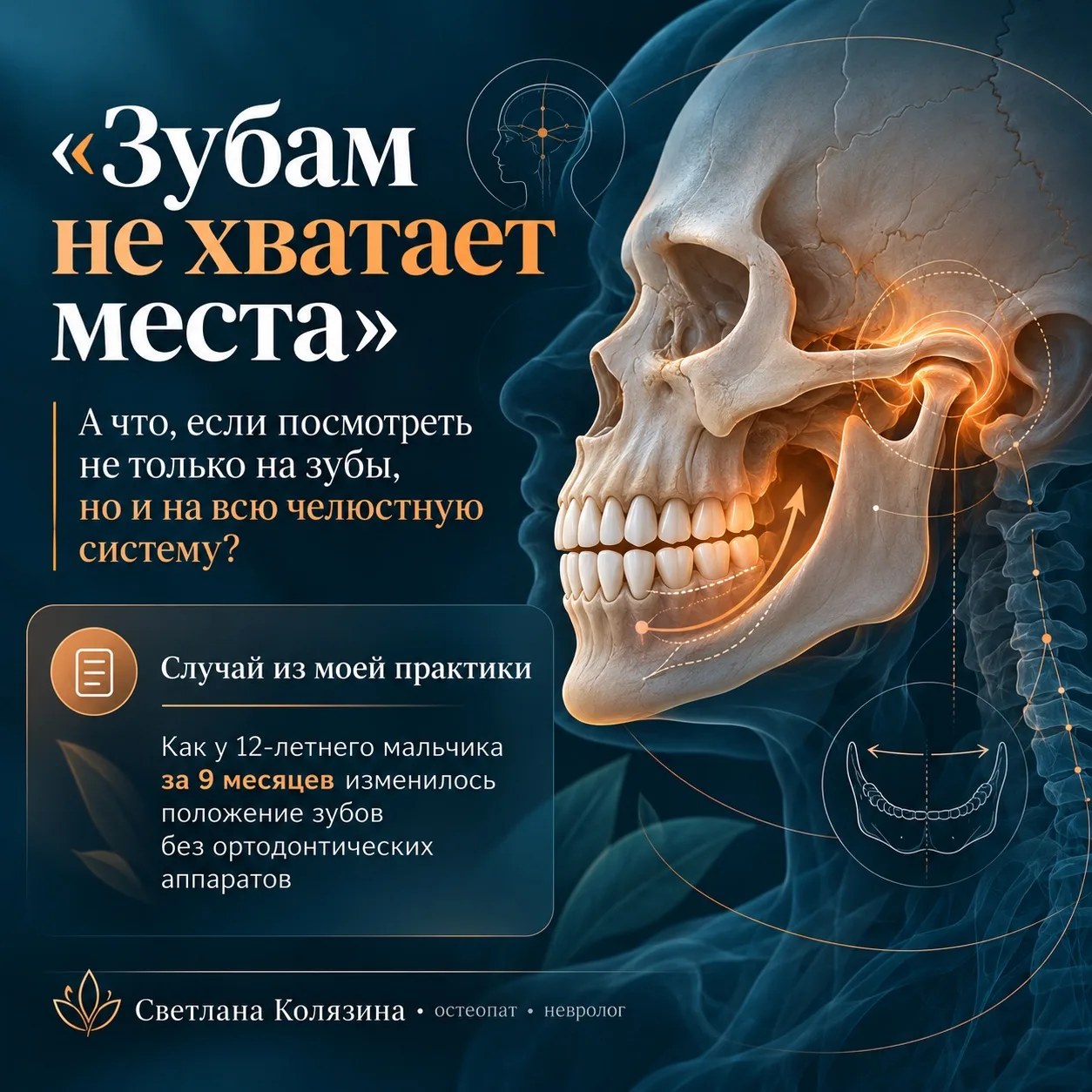 🔥 «Зубам не хватает места». А что, если посмотреть не только на зубы, но и на всю челю...