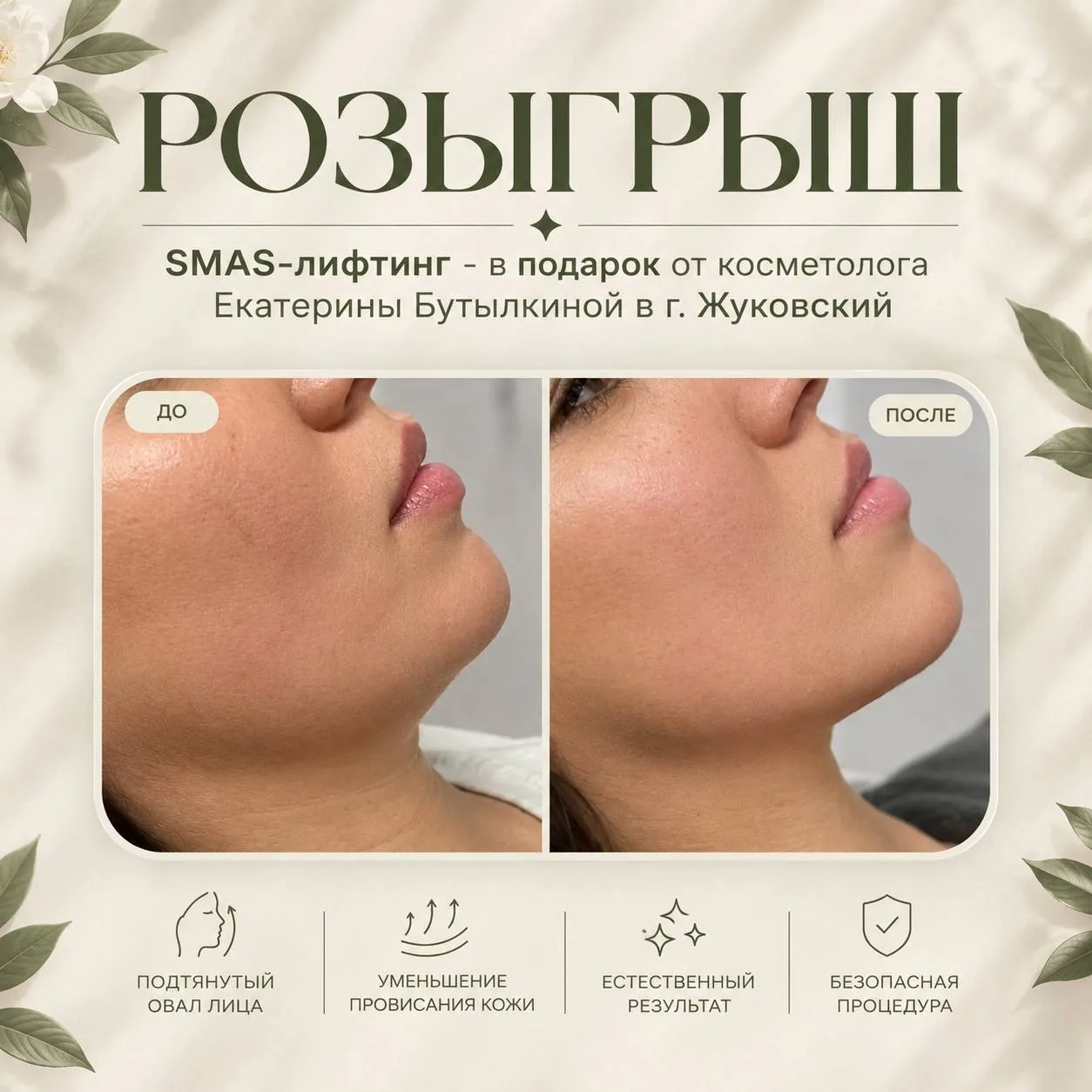 Жуковский, невероятный розыгрыш SMAS-лифтинга от косметолога Екатерины Бутылкиной🔥