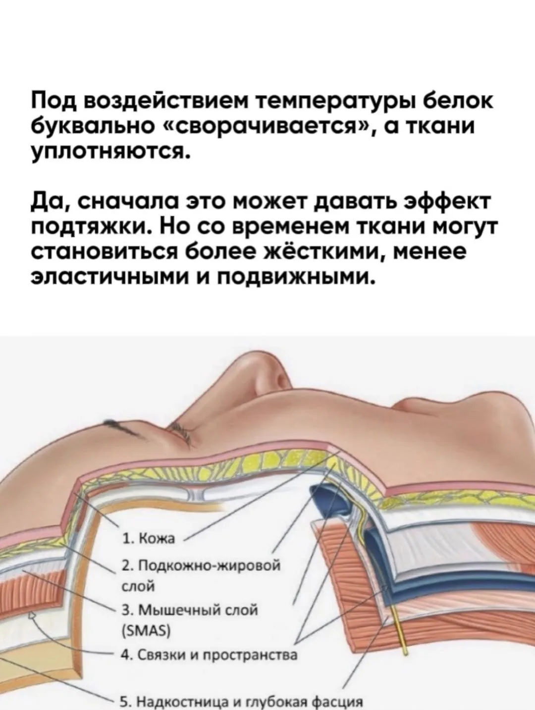 «Подтянуть лицо без операции». Звучит заманчиво. Но что происходит с тканями?