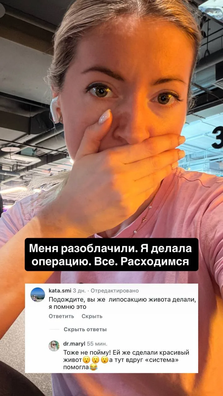 Меня разоблачили 😅 Я делала операцию на животе.