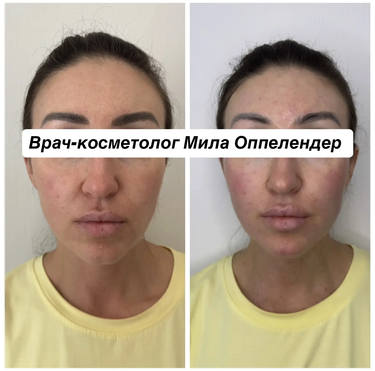 Про ЧЁТКИЙ ОВАЛ ЛИЦА👍