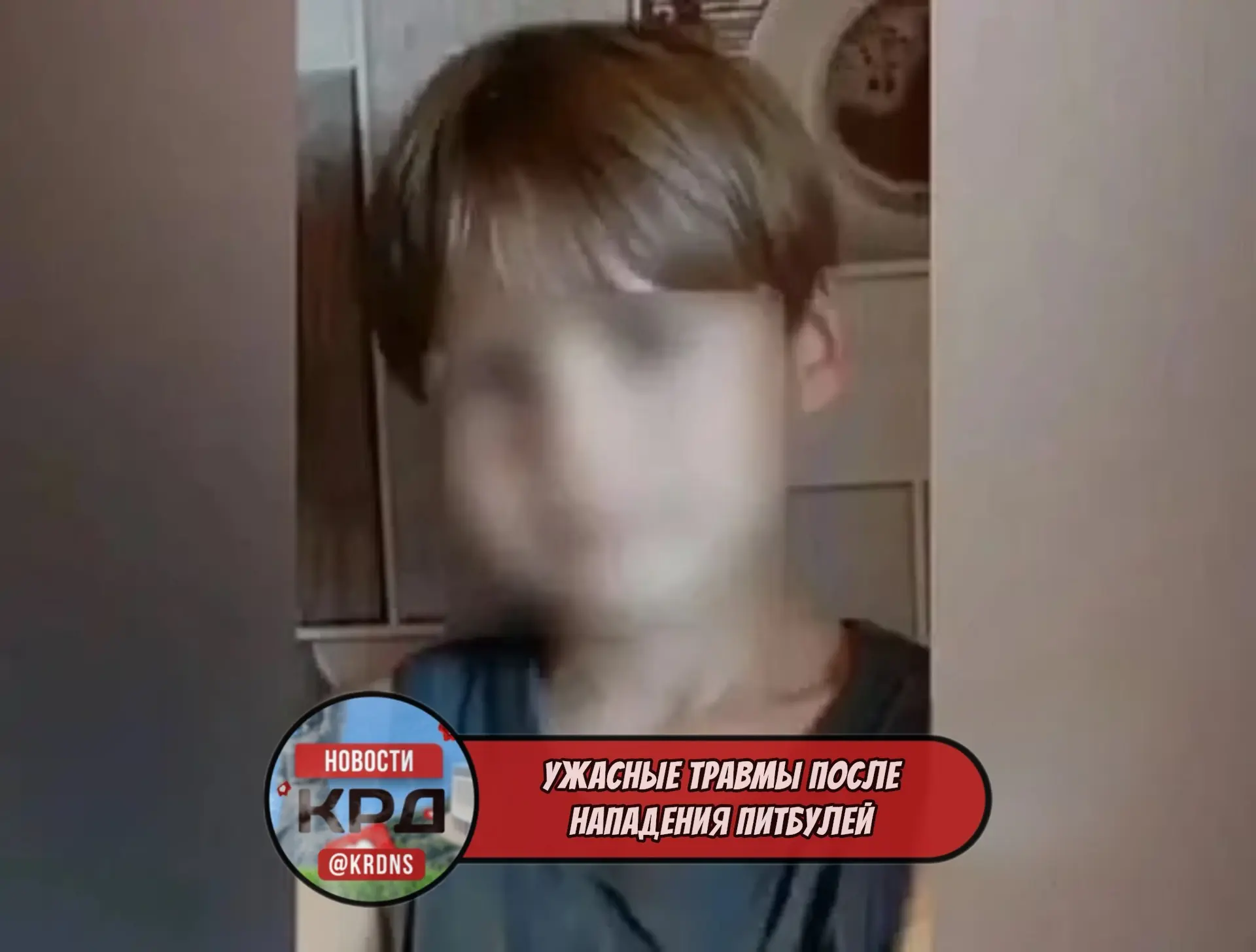🌀‼️Брат несовершеннолетнего, пострадавшего в результате нападения питбулей в Курганинс...