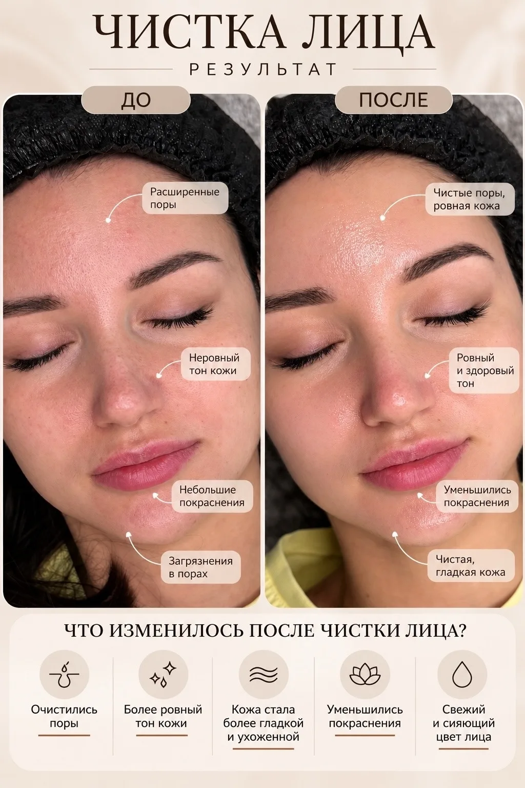 ✨ПРИГЛАШАЮ НА КОМБИНИРОВАННУЮ ЧИСТКУ ЛИЦА✨
