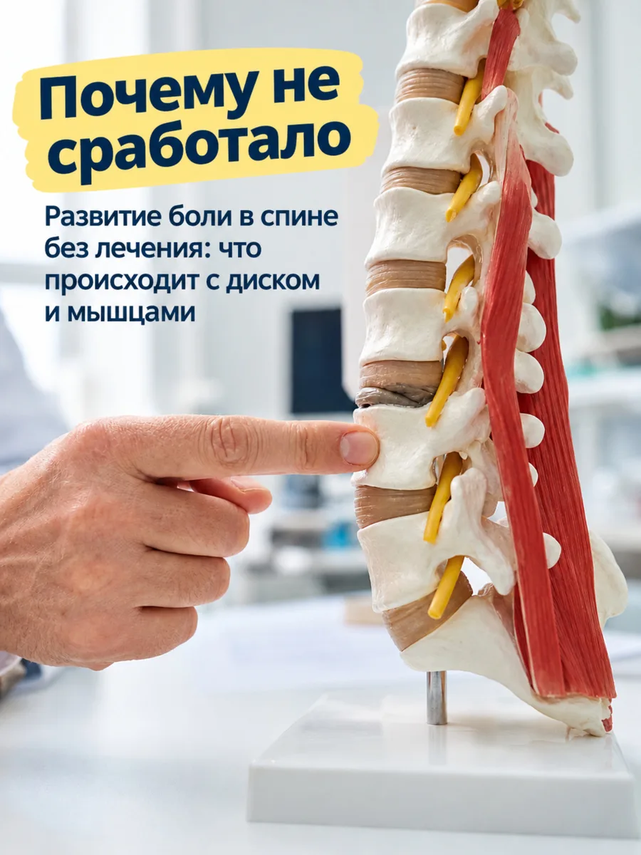 Почему не сработало: мазь от боли в спине.