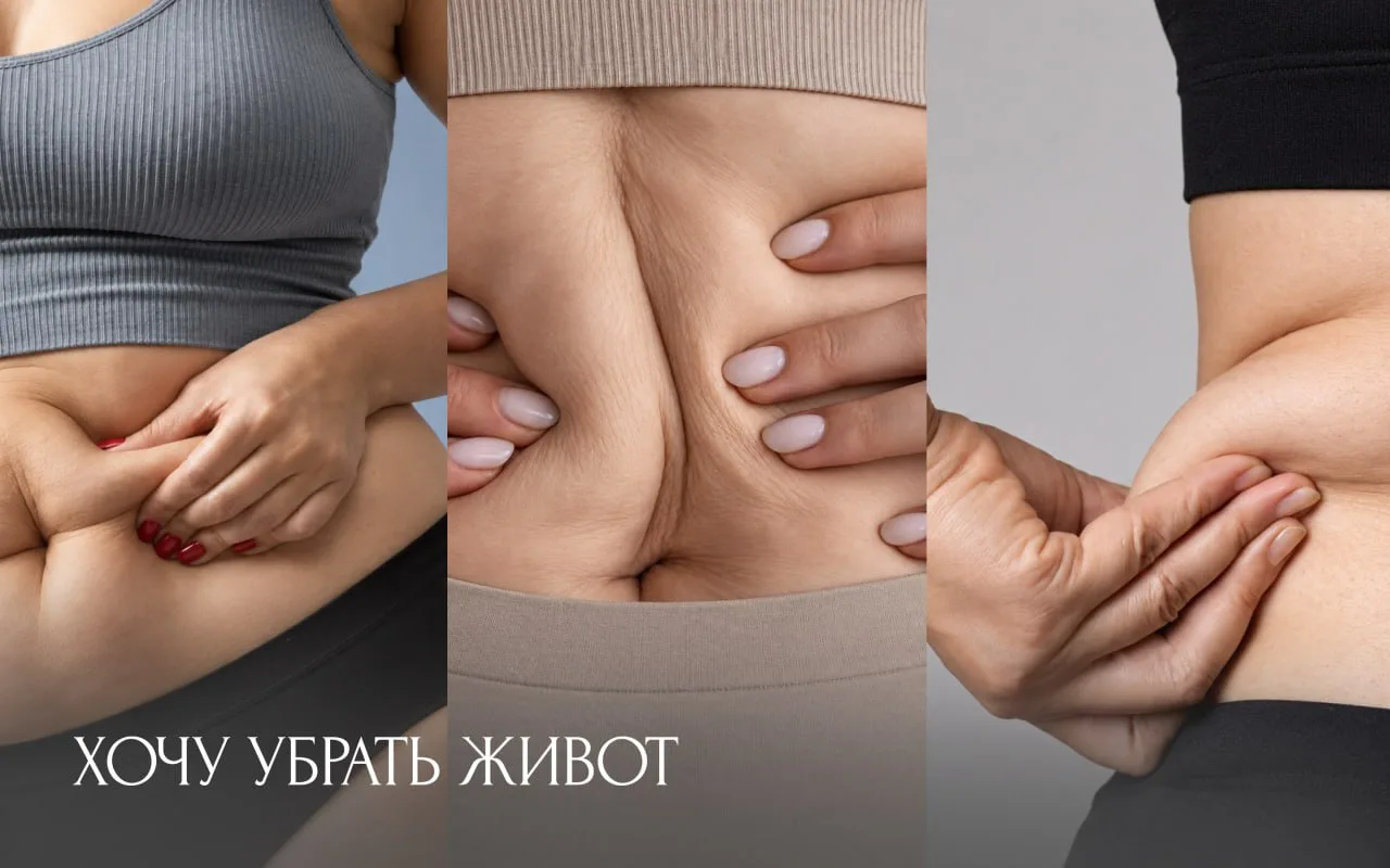 «Хочу убрать живот». Почему врач сначала уточняет, что именно вас беспокоит?