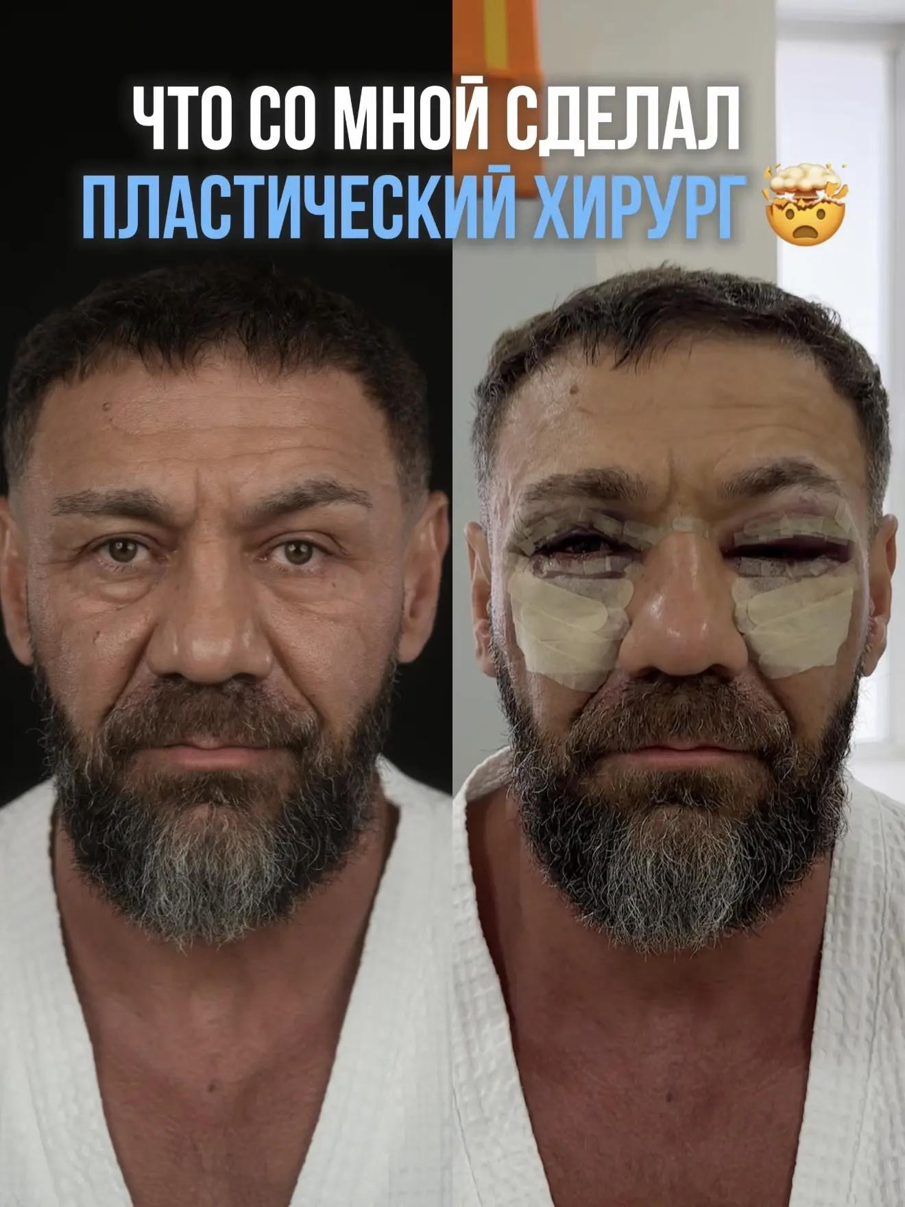 ЧТО СО МНОЙ СДЕЛАЛ ПЛАСТИЧЕСКИЙ ХИРУРГ?