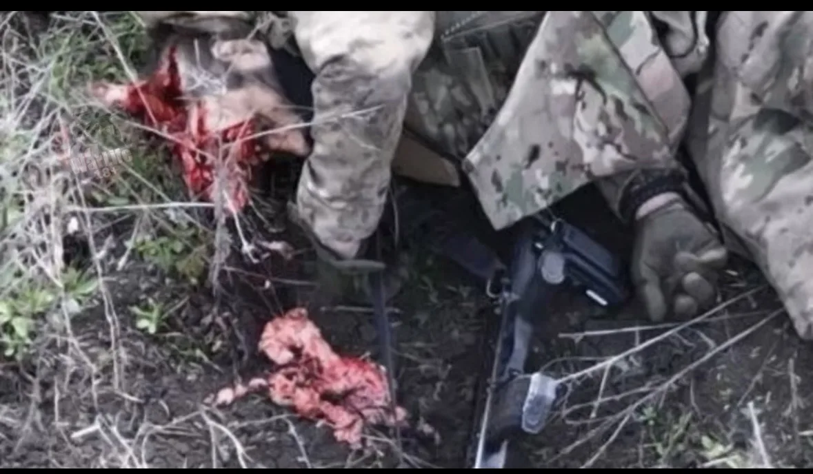 21+ Российский военный, попавший под атаку нового украинского FPV-дрона с искусственным...