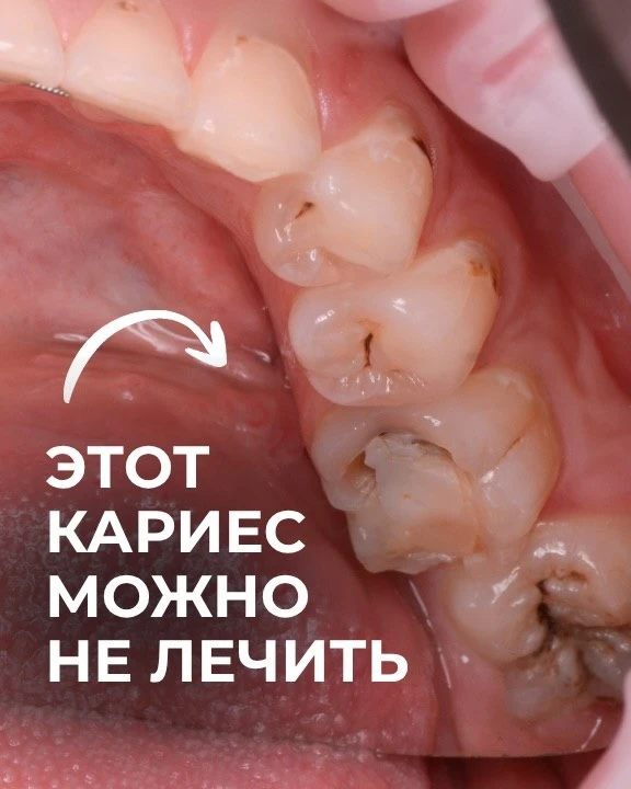 Сомневаться и искать второго мнения - это нормально.  Иногда оно может очень сильно изм...