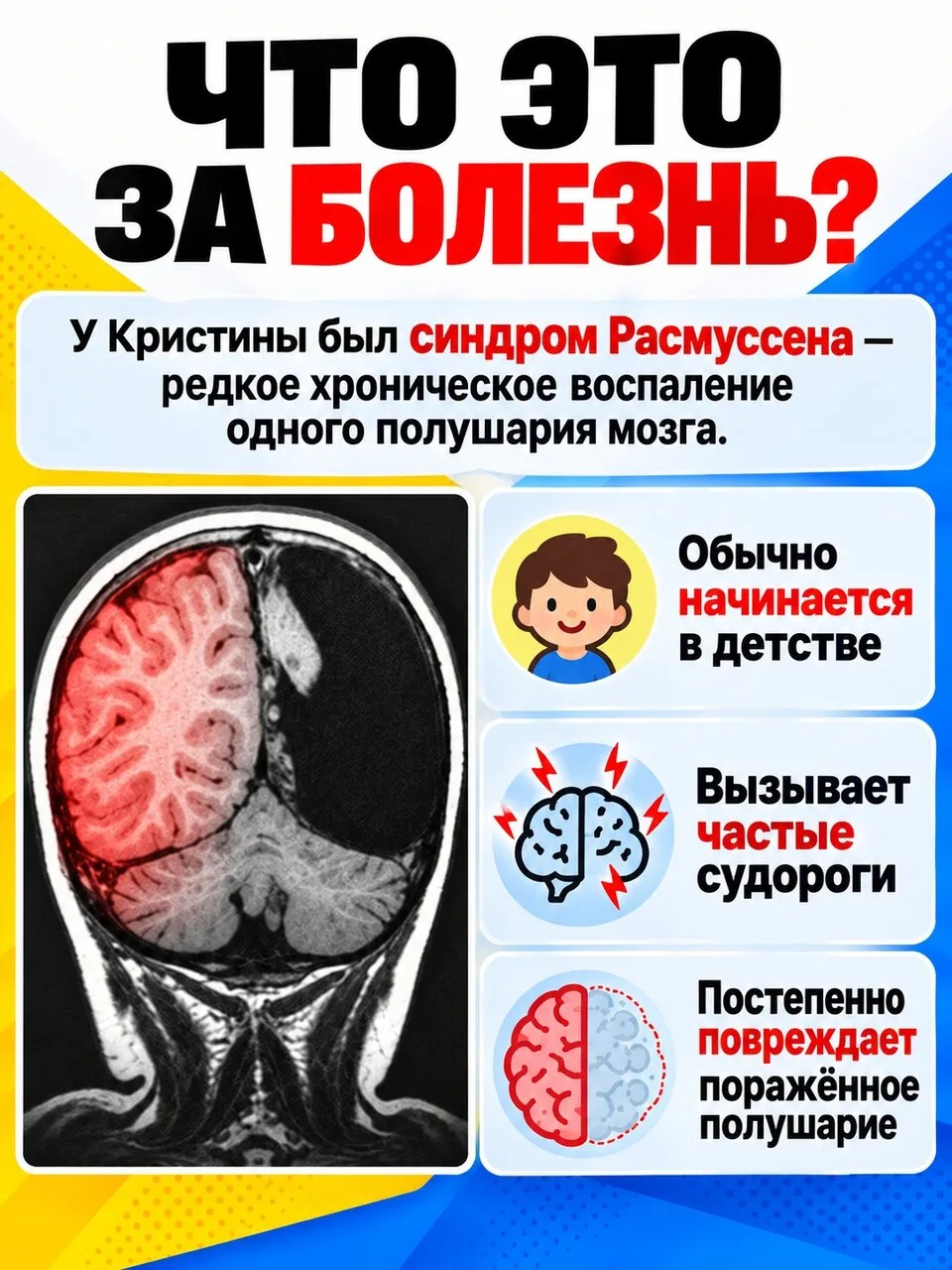 В 7 лет у Кристины Сэнтхаус всё началось с едва заметного подёргивания левой стопы. Чер...