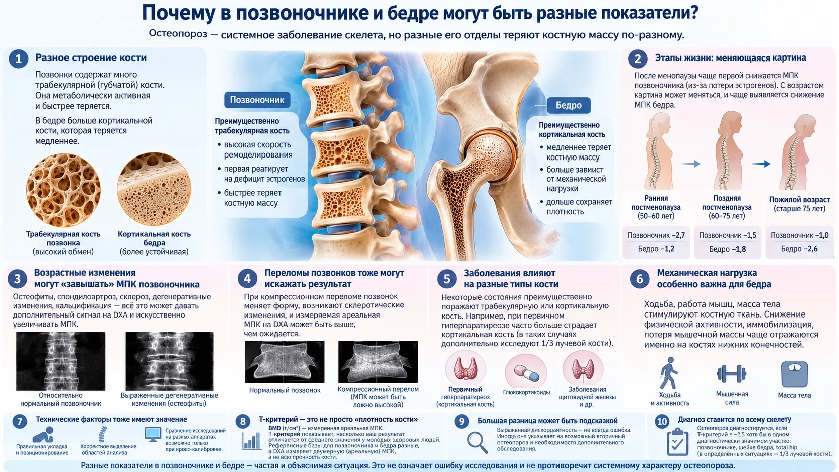 🦴 ПОЧЕМУ В ПОЗВОНОЧНИКЕ ОСТЕОПОРОЗ, А В БЕДРЕ НОРМА?