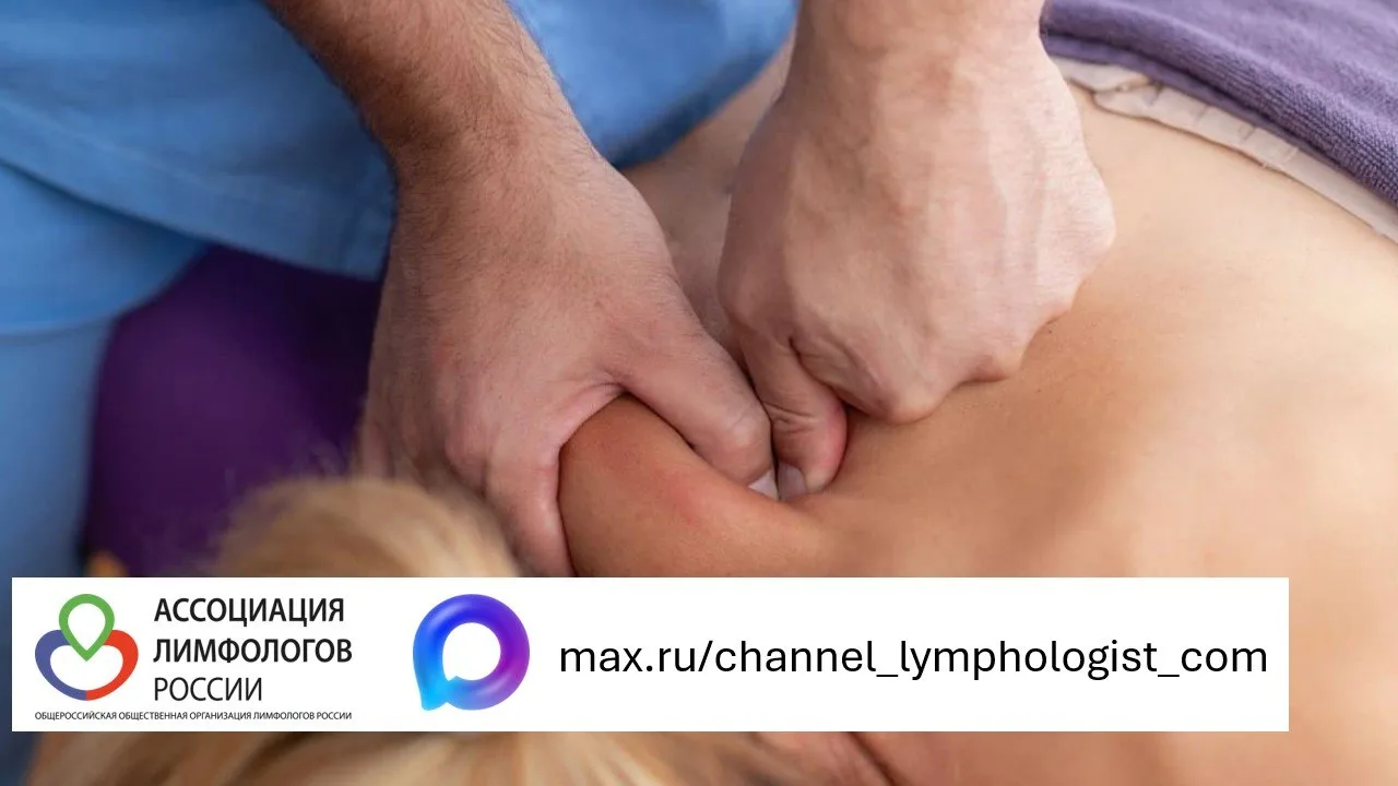 КОНСЕРВАТИВНОЕ ЛЕЧЕНИЕ ЛИМФЕДЕМЫ
