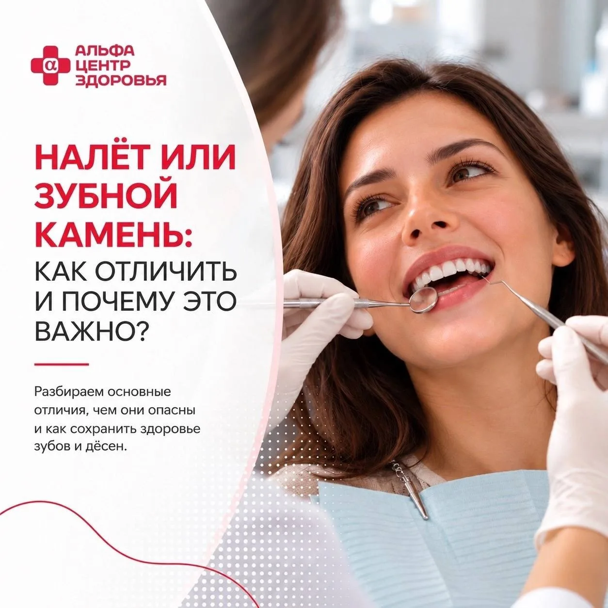 Налёт или зубной камень: как отличить и почему это важно? 🦷