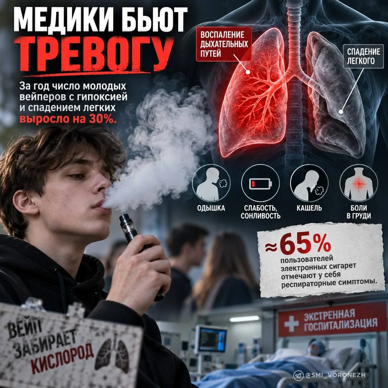 Медики сообщают о росте числа молодых вейперов с гипоксией и спадением легких на 30 про...