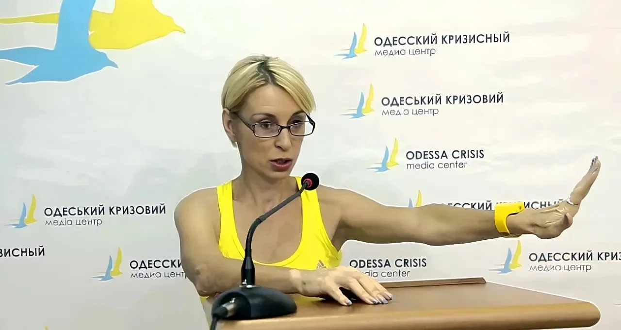 Сдали нервы: депутат ВРУ назвала Трампа «обезьяной», но быстро удалила пост