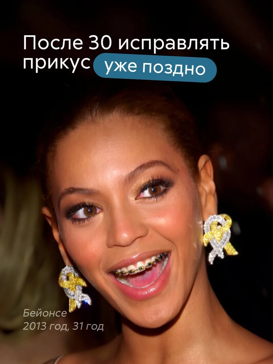 Есть мнение, что зубы можно исправлять только в юном возрасте. Поэтому после 30 ортодон...