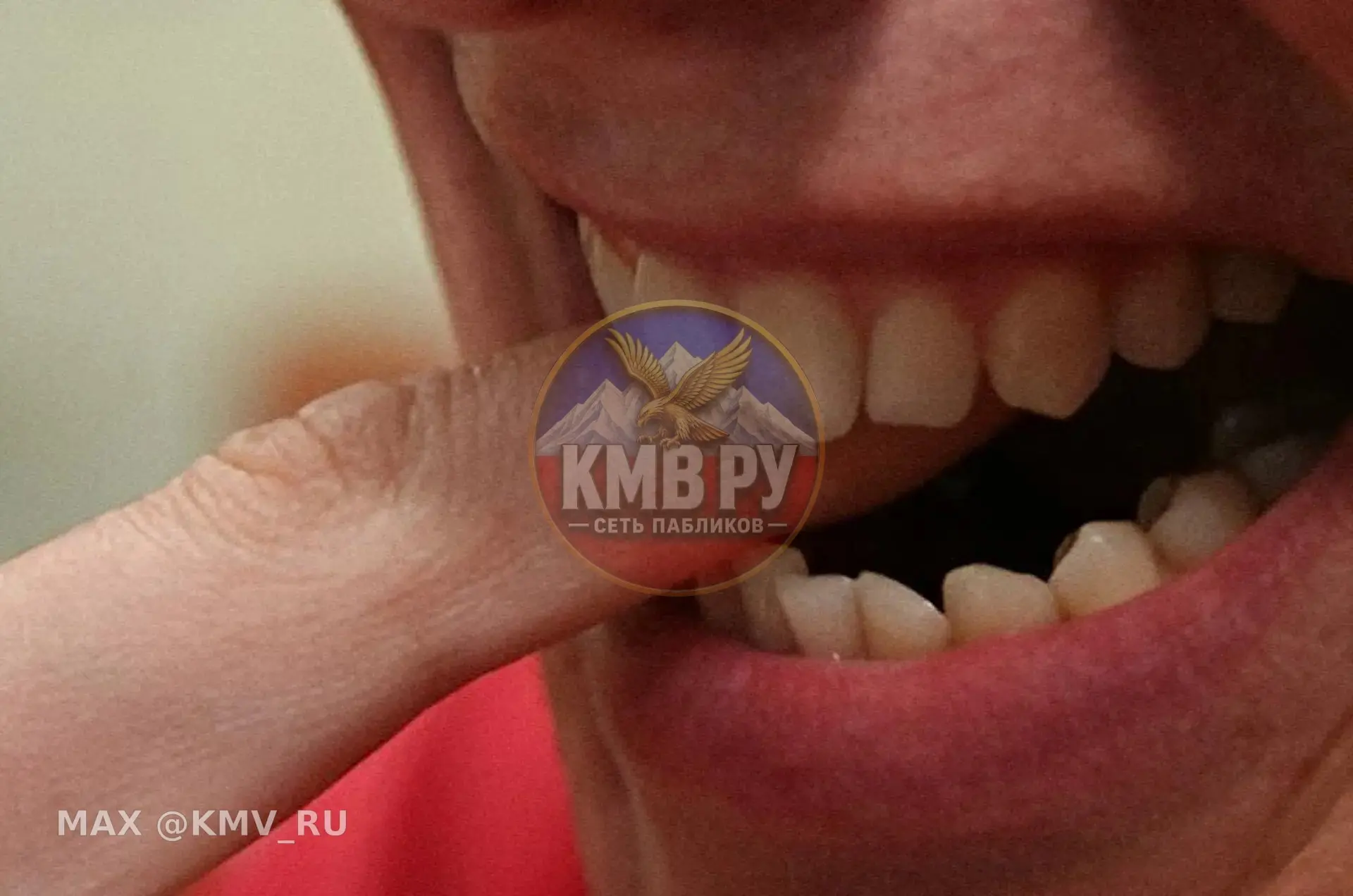 Сотрудник ЖКХ Минераловодского округа в ходе конфликта откусил фалангу пальца коллеге
