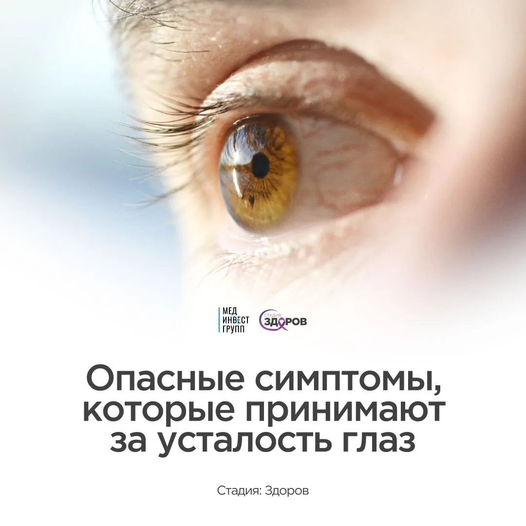 Всемирный день зрения: что нельзя списывать на усталость глаз👀