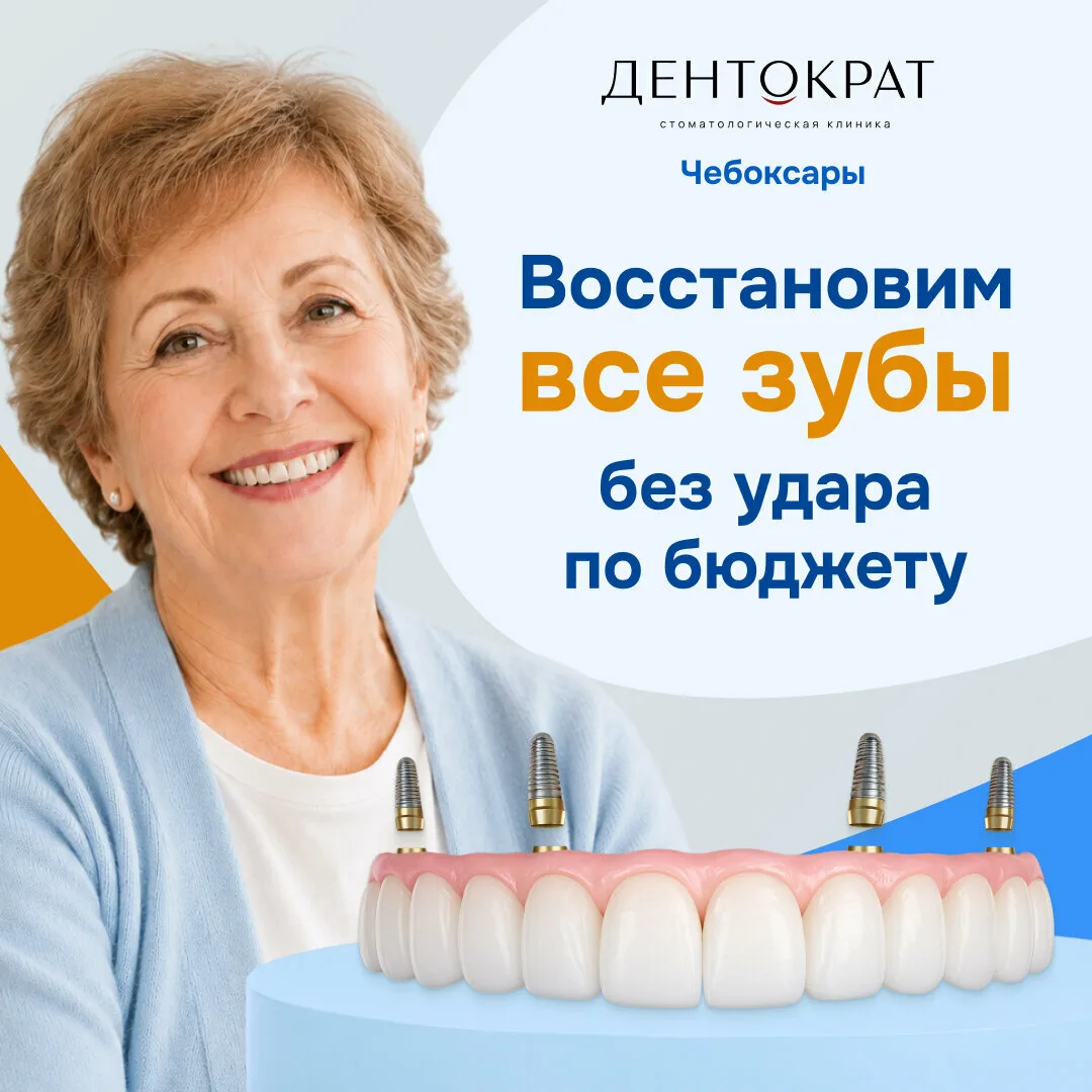 «Все зубы сразу»: 4 импланта + несъёмный протез