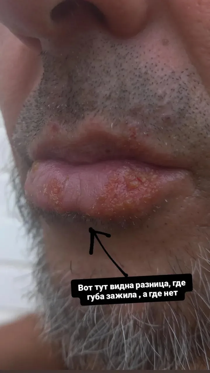 Это очень крутой бальзам для губ🔥