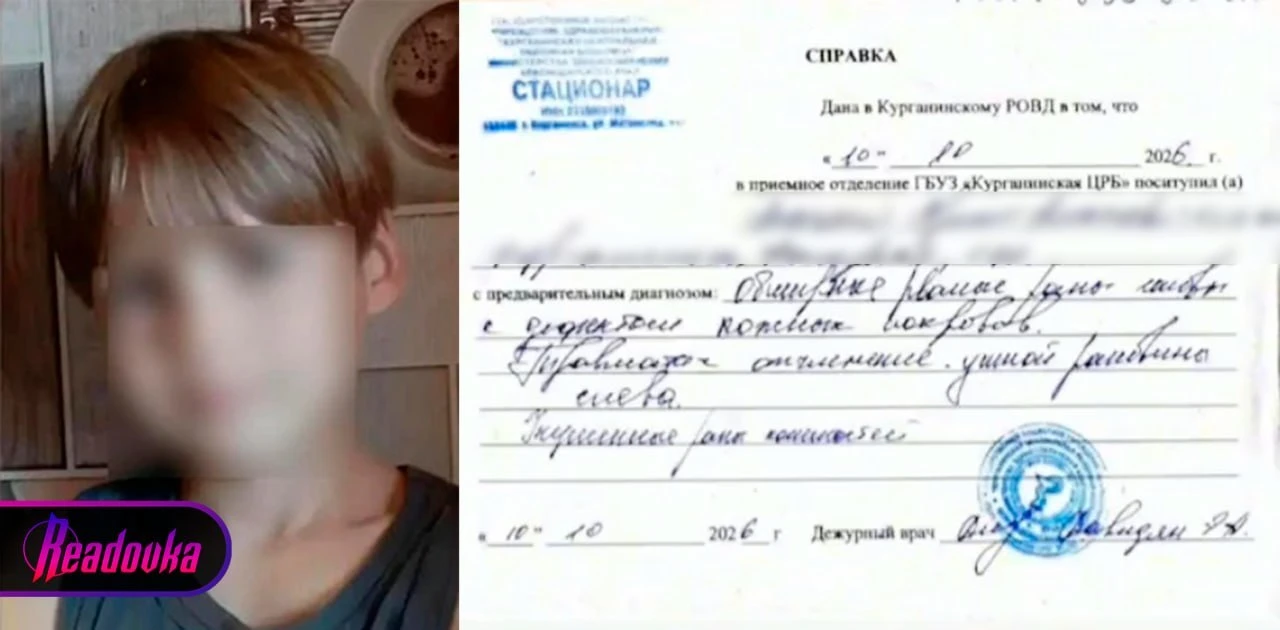 Охранник карпятника в Курганинске натравил на детей свору питбулей — один ребенок в коме