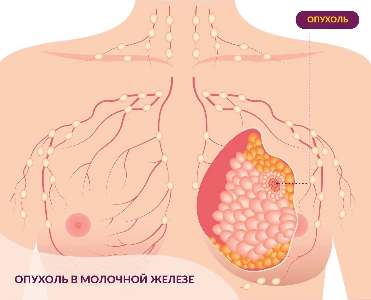С 12-18.10.2026 проходит Неделя борьбы против рака  молочной железы (в честь месяца бор...