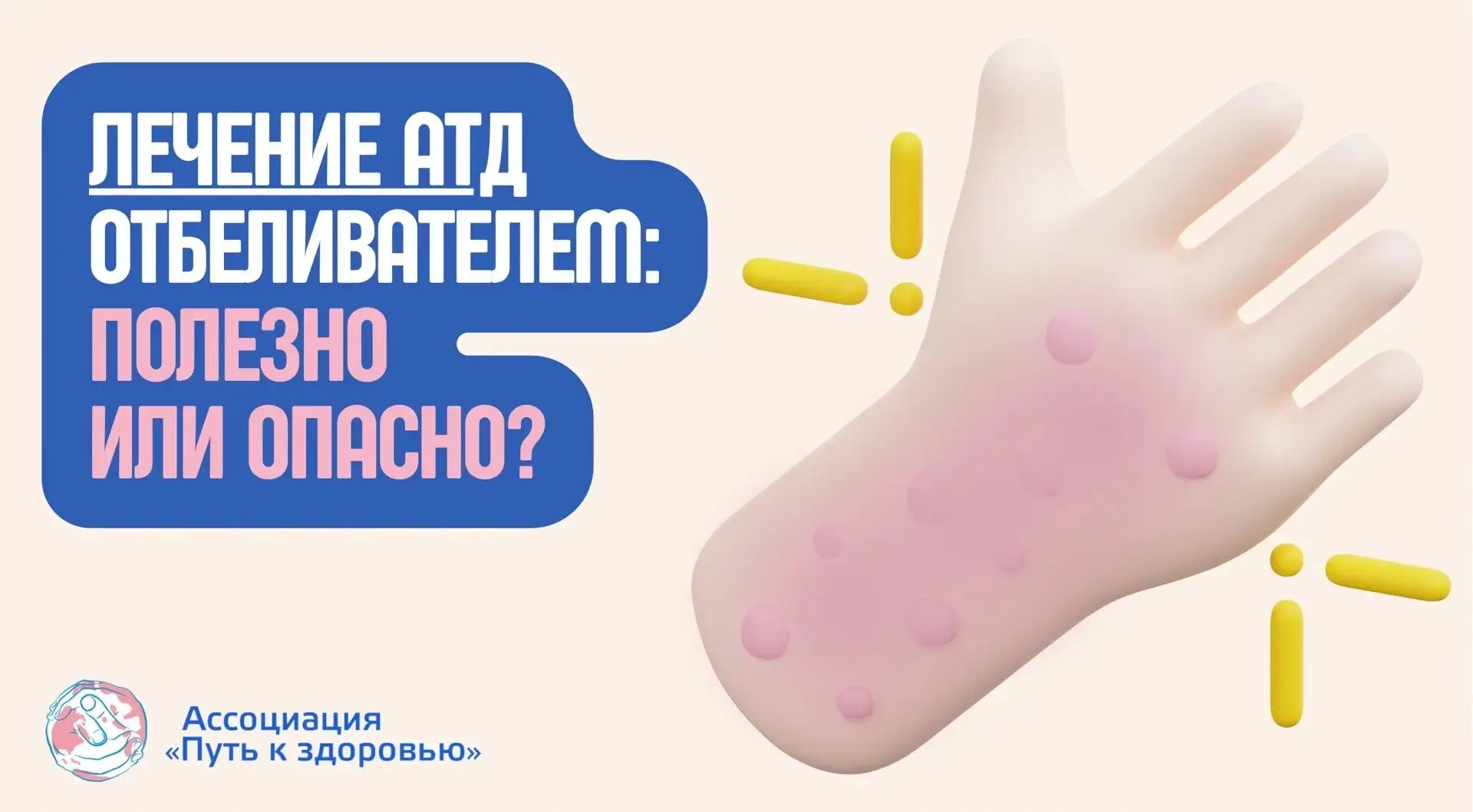 Лечение атопического дерматита... белизной? Опасный тренд из соцсетей