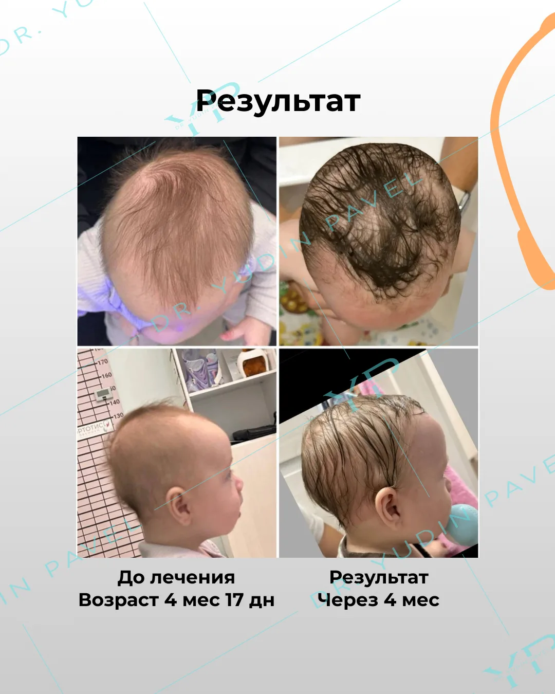 4 месяца — и результат налицо! 🎯