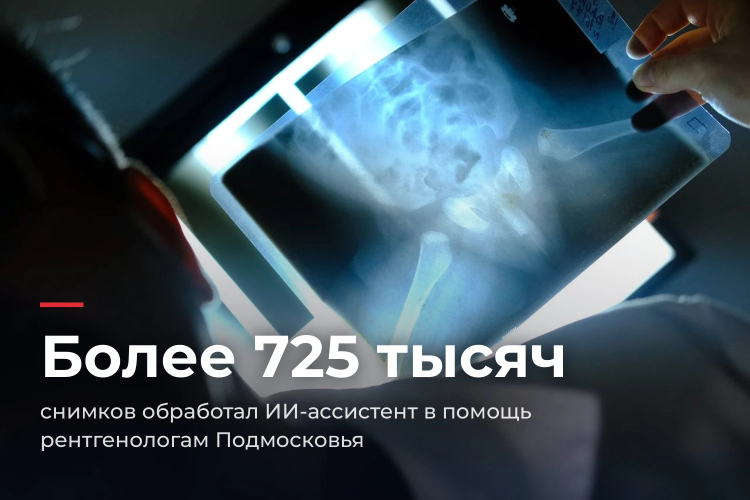 🩻 Искусственный интеллект помог рентгенологам Подмосковья проверить более 725 тысяч сн...