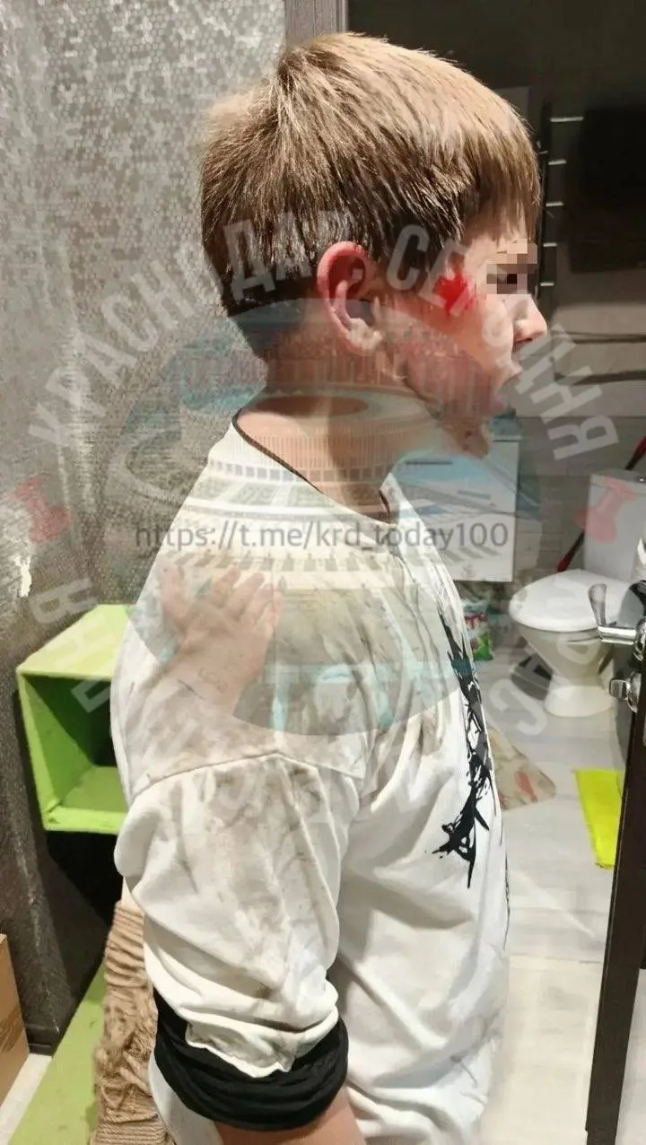 📌В полиции потеряли заявление об избиении 11-летнего ребёнка, утверждает мать