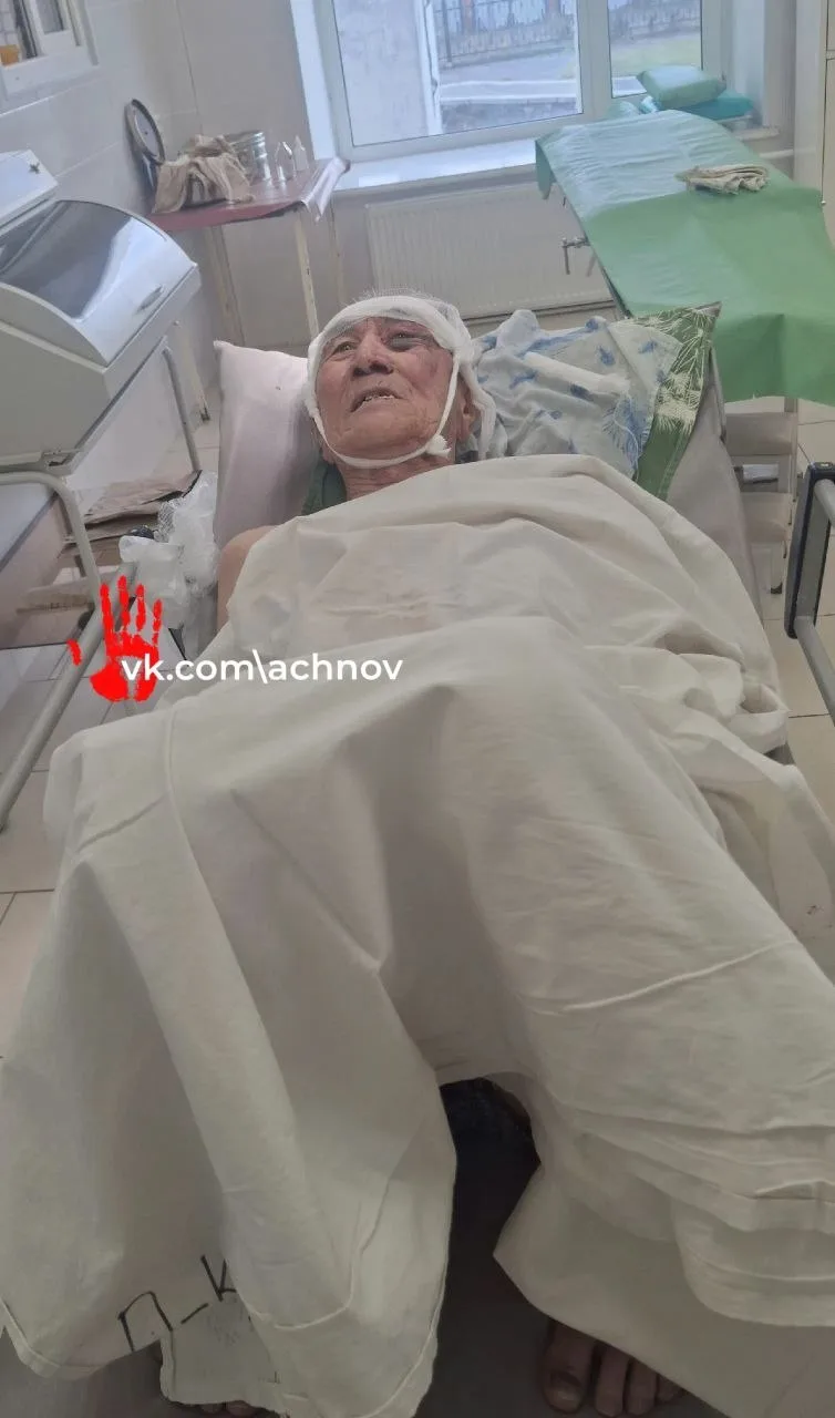 😱 Рулон бикроста едва не убил пенсионера в Троицке