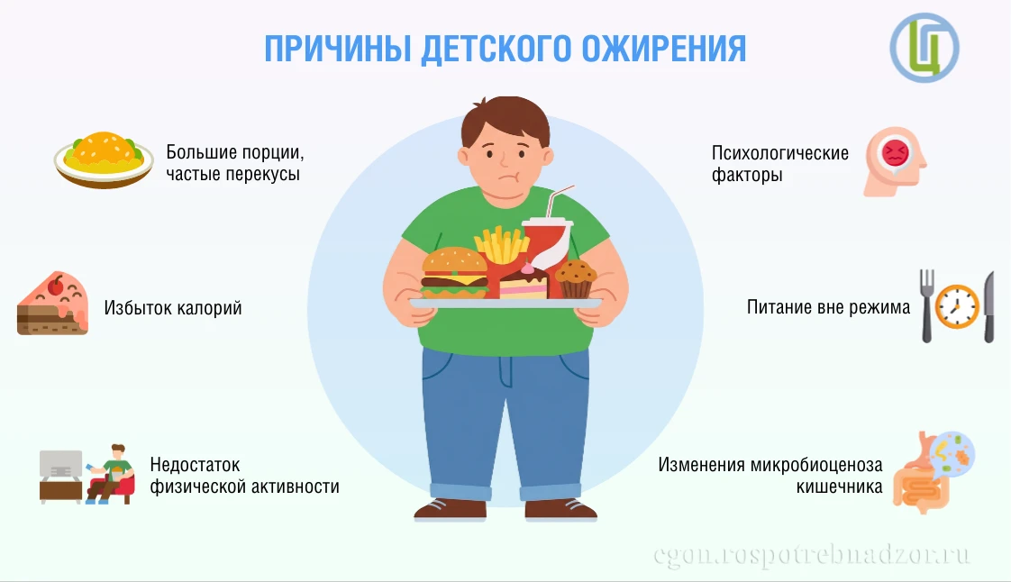 Причины детского ожирения