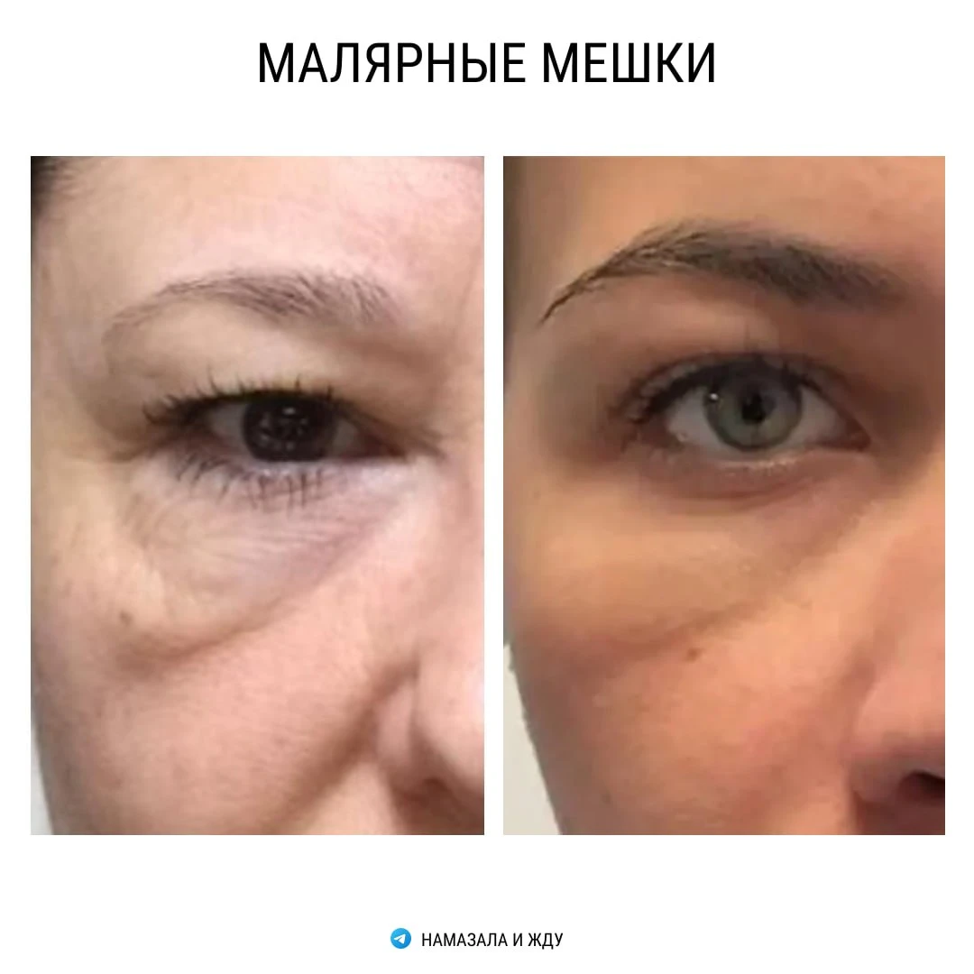 Малярные мешки
