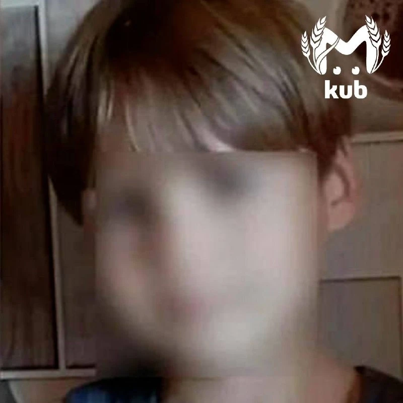 Четыре собаки искусали 12-летнего мальчика на базе отдыха в Курганинске. На хозяйку мес...