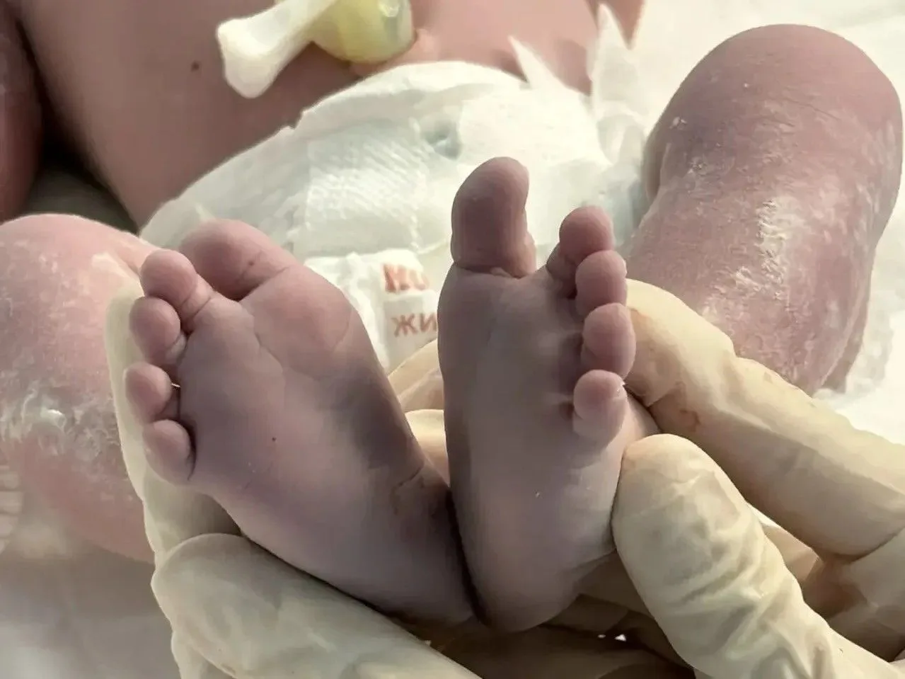 👶 В Калининградской области врачи помогли женщине стать мамой и избавиться от крупной ...
