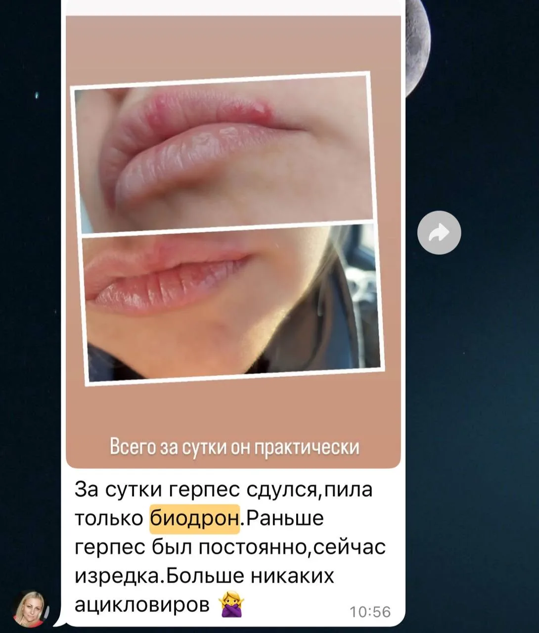А кто-то пользуется вместо Ацикловира им при герпесе❤️‍🔥