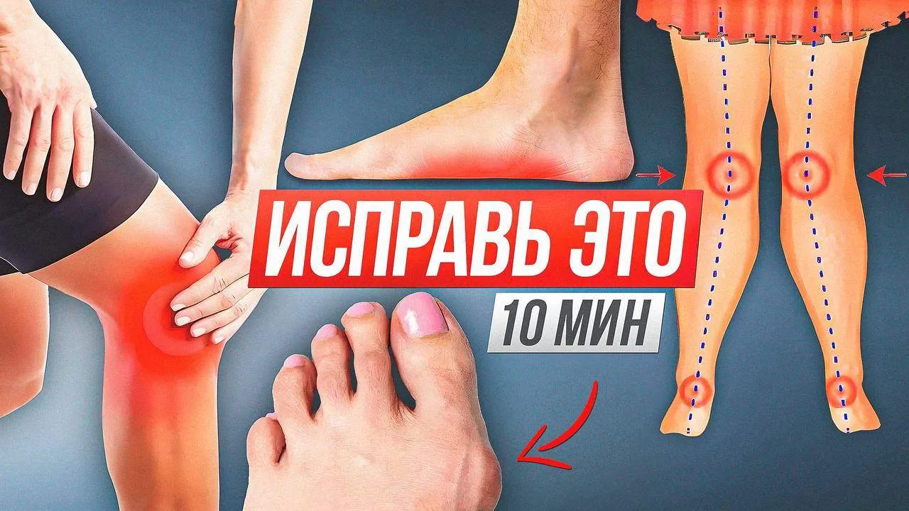 САМАЯ ОПАСНАЯ ОБУВЬ, ПРОБЛЕМЫ СО СТОПАМИ И ОСАНКОЙ.