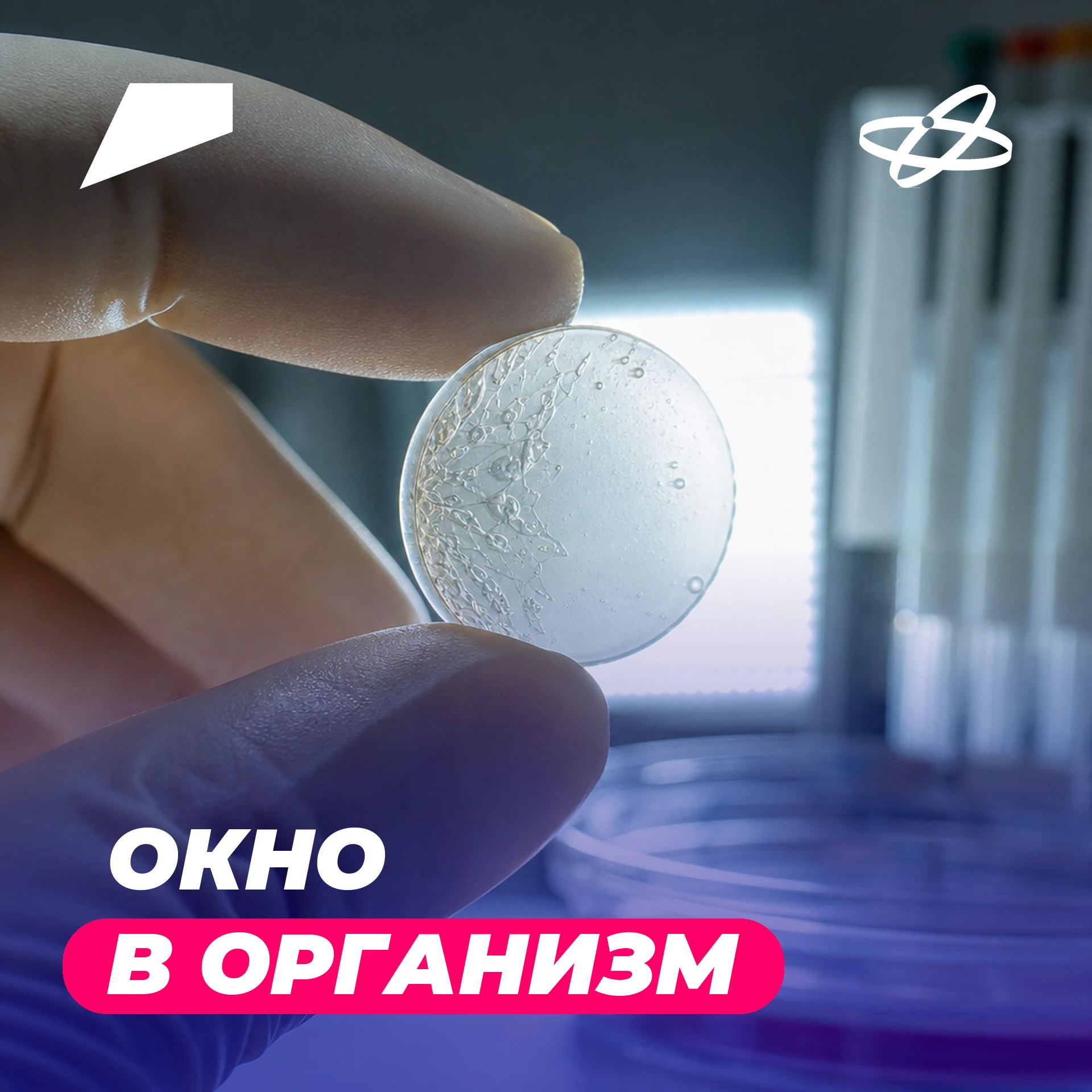 Нижегородские ученые создали прозрачную нанокерамику, которая «дружит» с живыми тканями 🤝