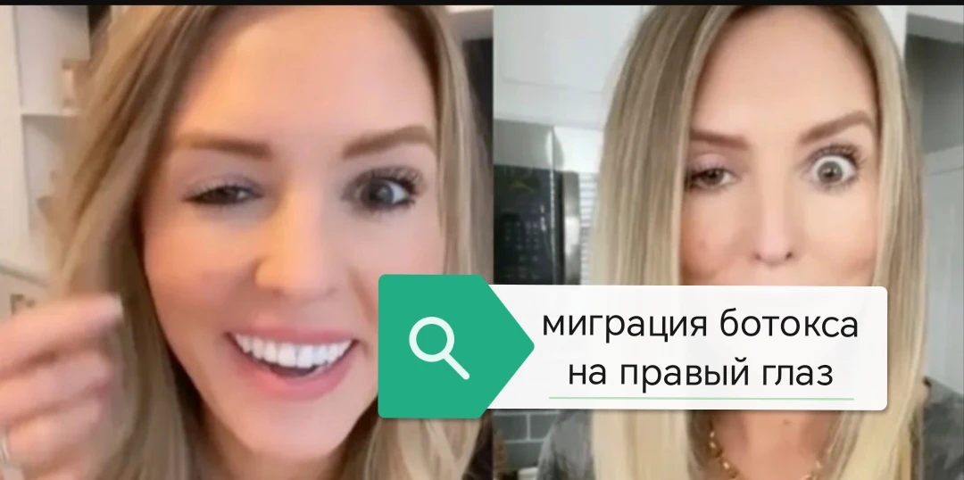 Ботокс: когда «красота» требует слишком высокой цены. Истории, которые не скрывают посл...
