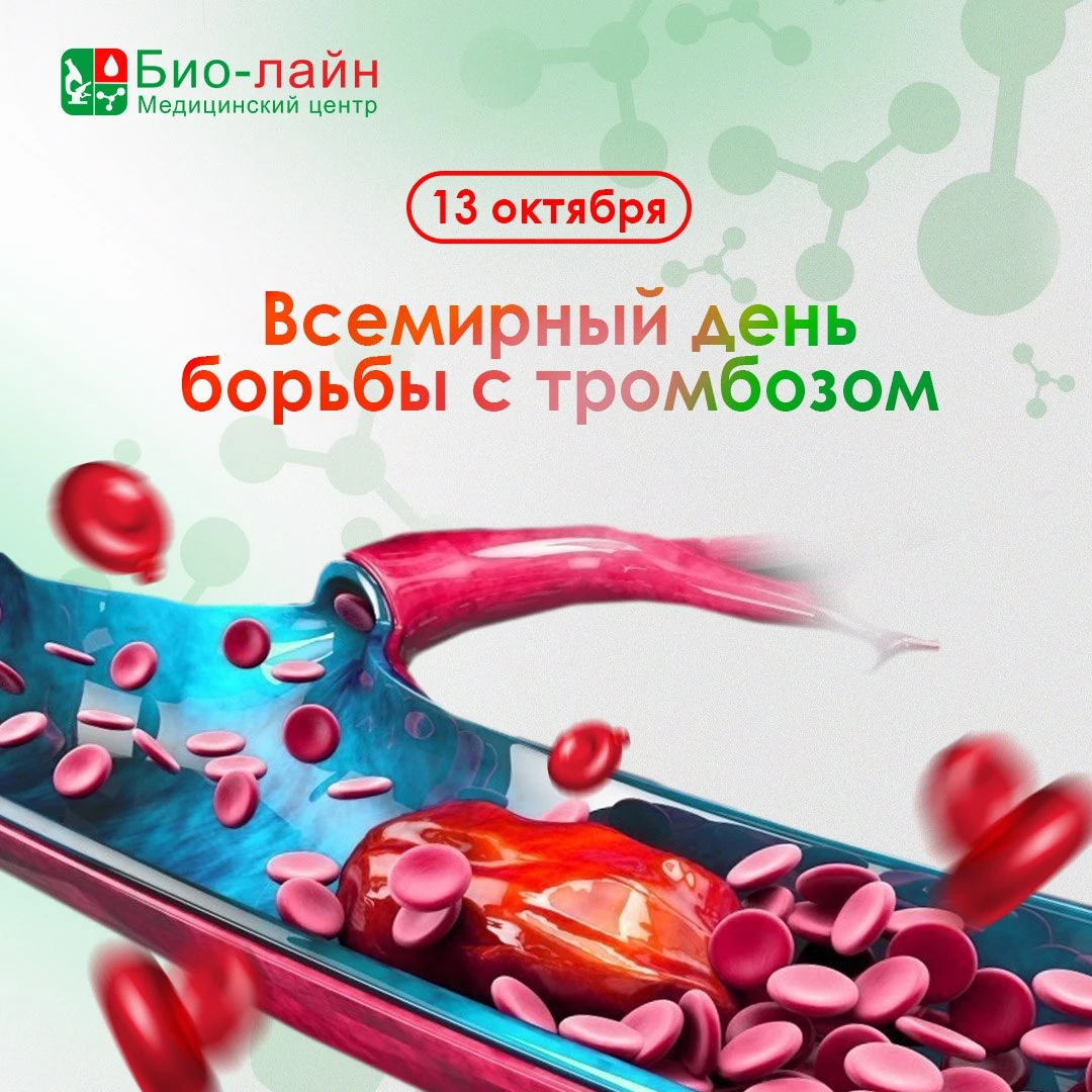 13 октября — Всемирный день борьбы с тромбозом