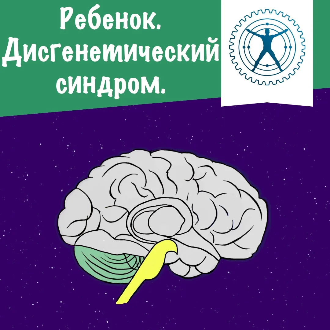 Ребенок. Дисгенетический синдром.