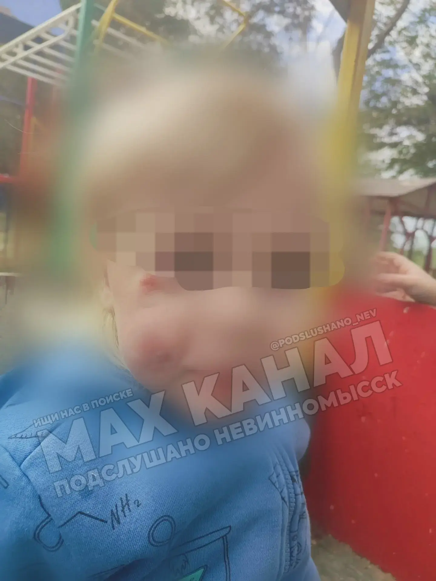 ⚠️ Отверстие на мостике детской площадки