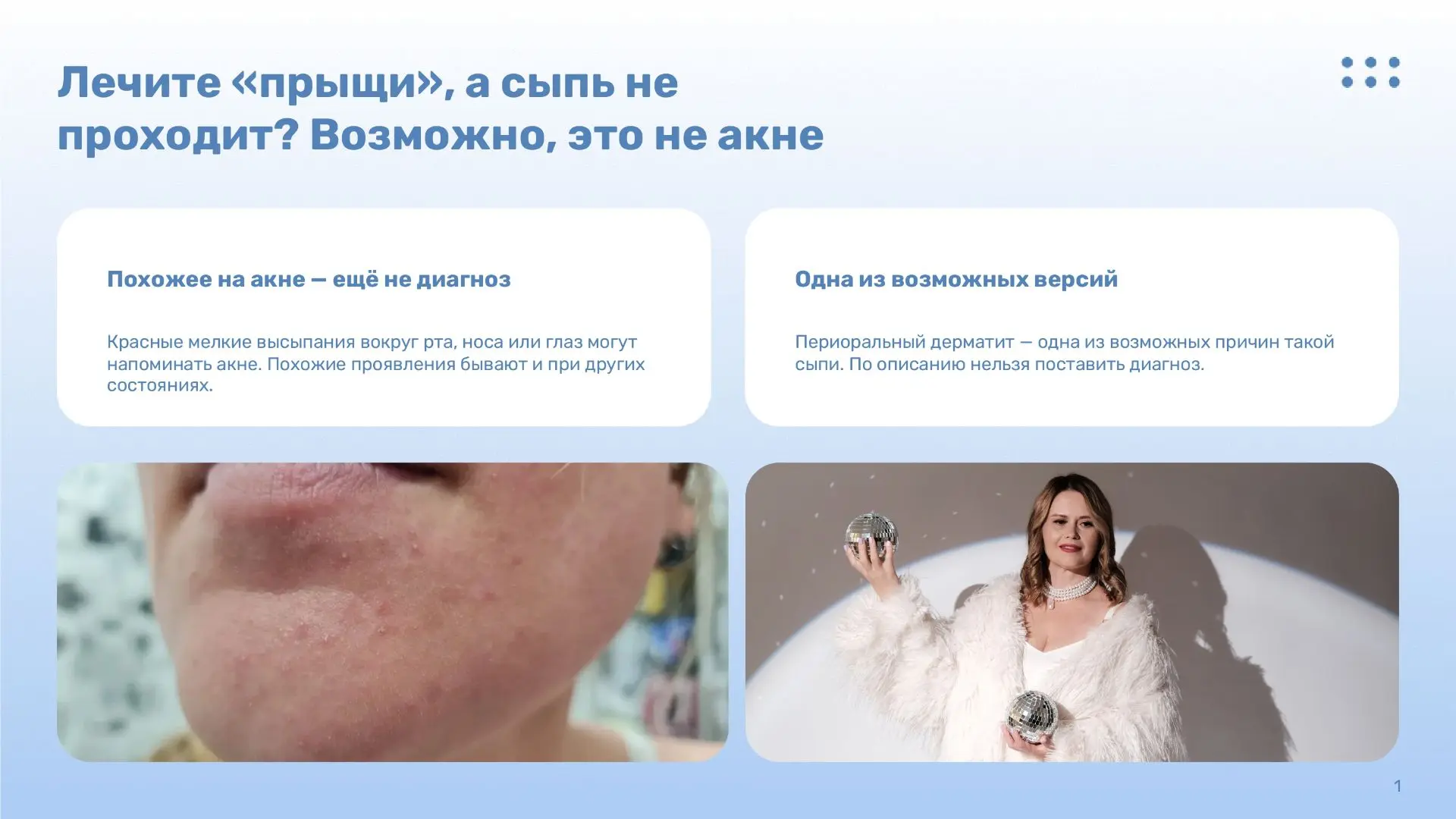 🔍 Вы лечите это от прыщей, а оно только расползается? Главный секрет высыпаний вокруг рта