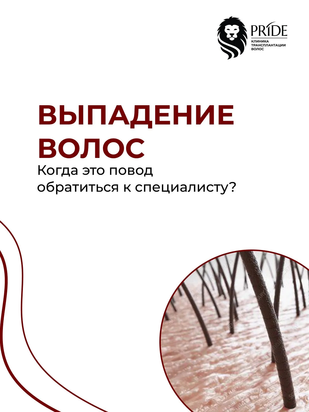 Выпадение волос не всегда означает проблему. Но важно замечать изменения вовремя.