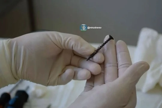 На Урале 2-летний мальчик напоролся глазом на саморез