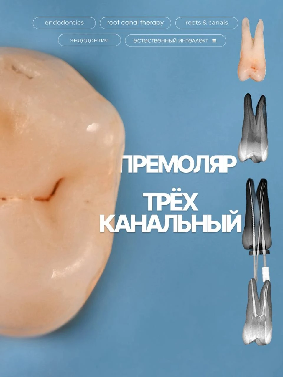 ✨Любите ли вы верхние премоляры как люблю их я?