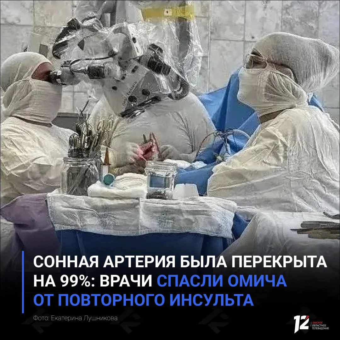 🧑‍⚕️ Сонная артерия была перекрыта на 99%: врачи спасли омича от повторного инсульта
