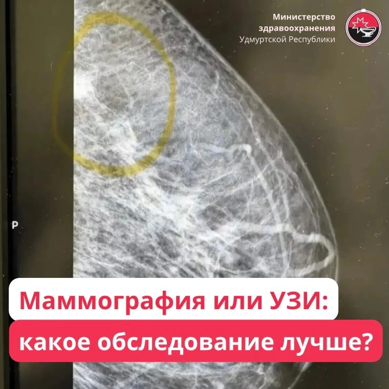 У маммографии и УЗИ свои задачи и область применения.