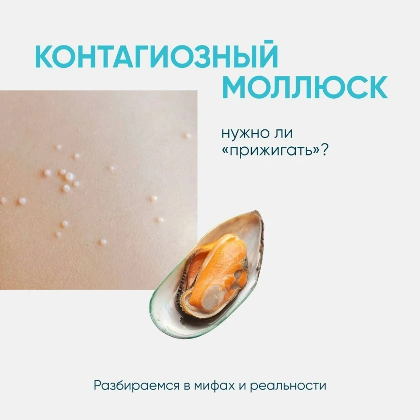 🦠 Контагиозный моллюск: паниковать или наблюдать?